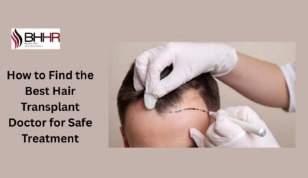 best hair transplant doctor