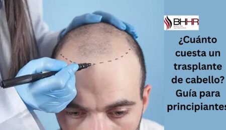 trasplante de pelo precio