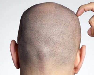 زراعة-الشع1