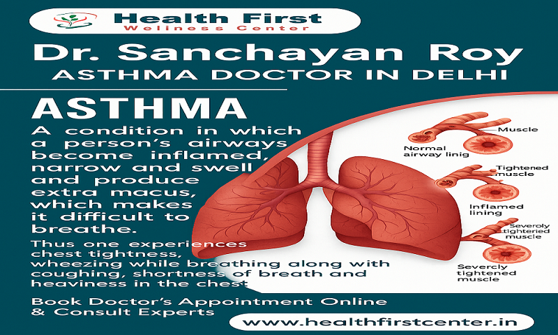 Top Asthma Specialist Doctor Near Me – Dr. Sanchayan Roy