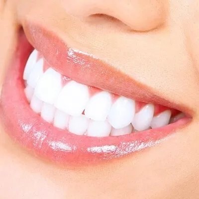 Laser-teeth-whitening-treatment-in-Islamabad