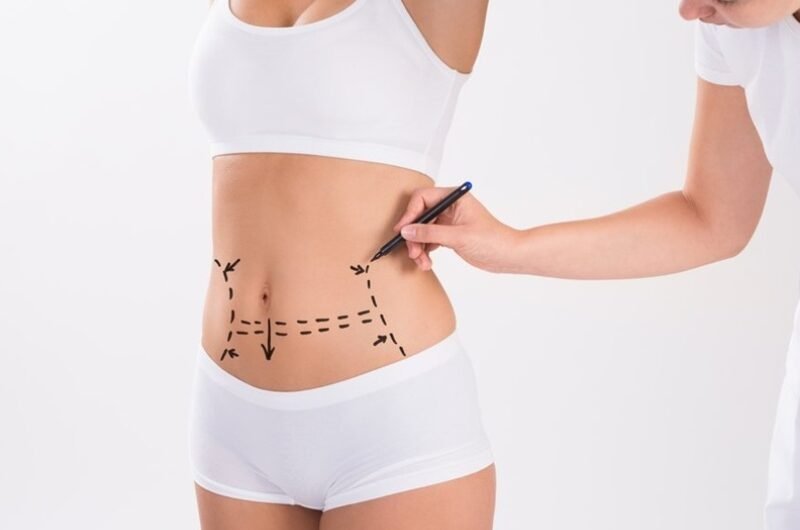 Tummy-Tuck-in-Islamabad.pk_