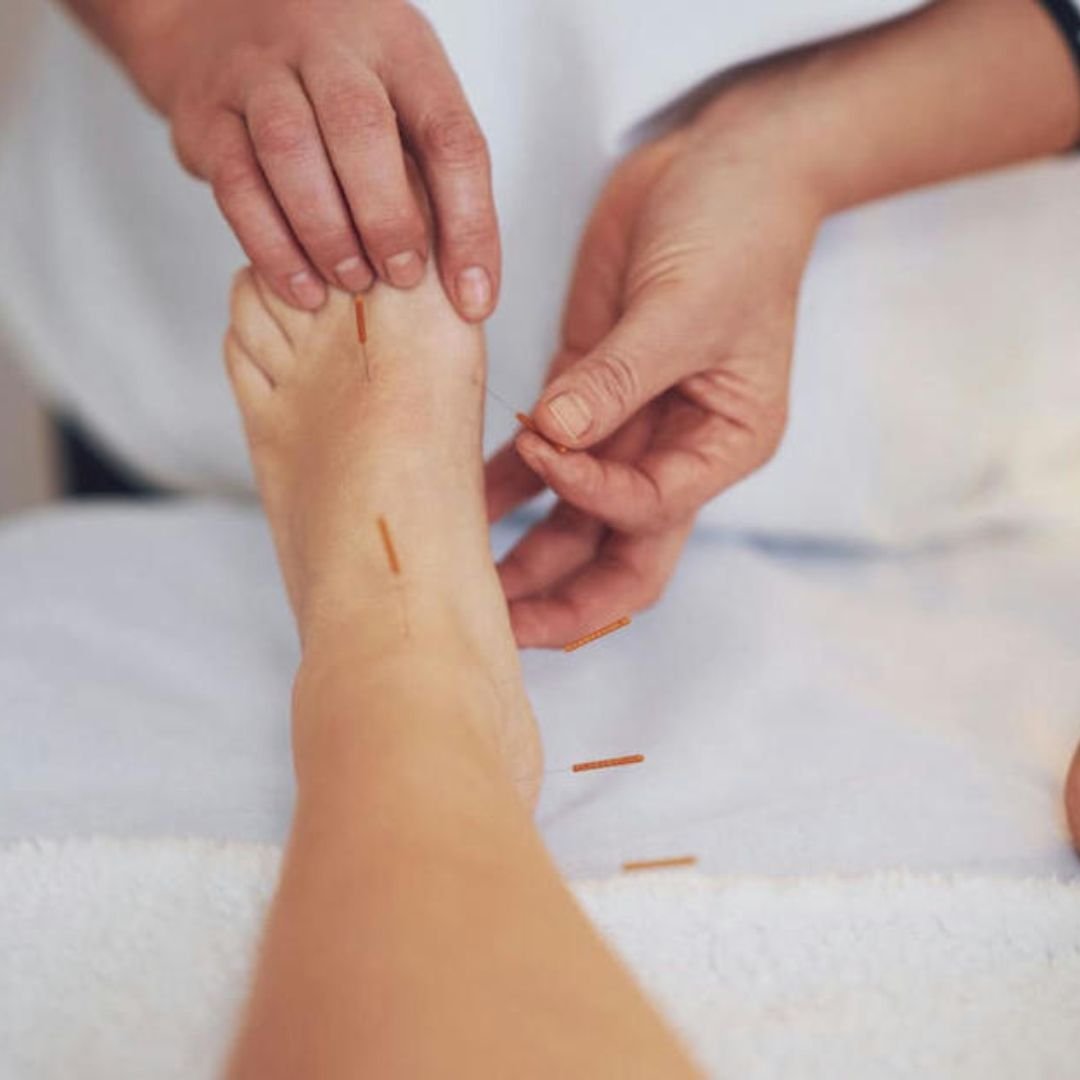 Acupuncture Treatment For Foot Pain