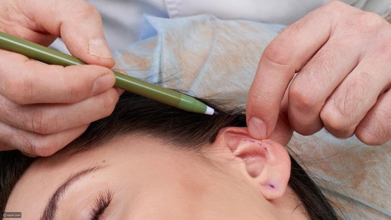 Ear-Reshaping-in-Islamabad2