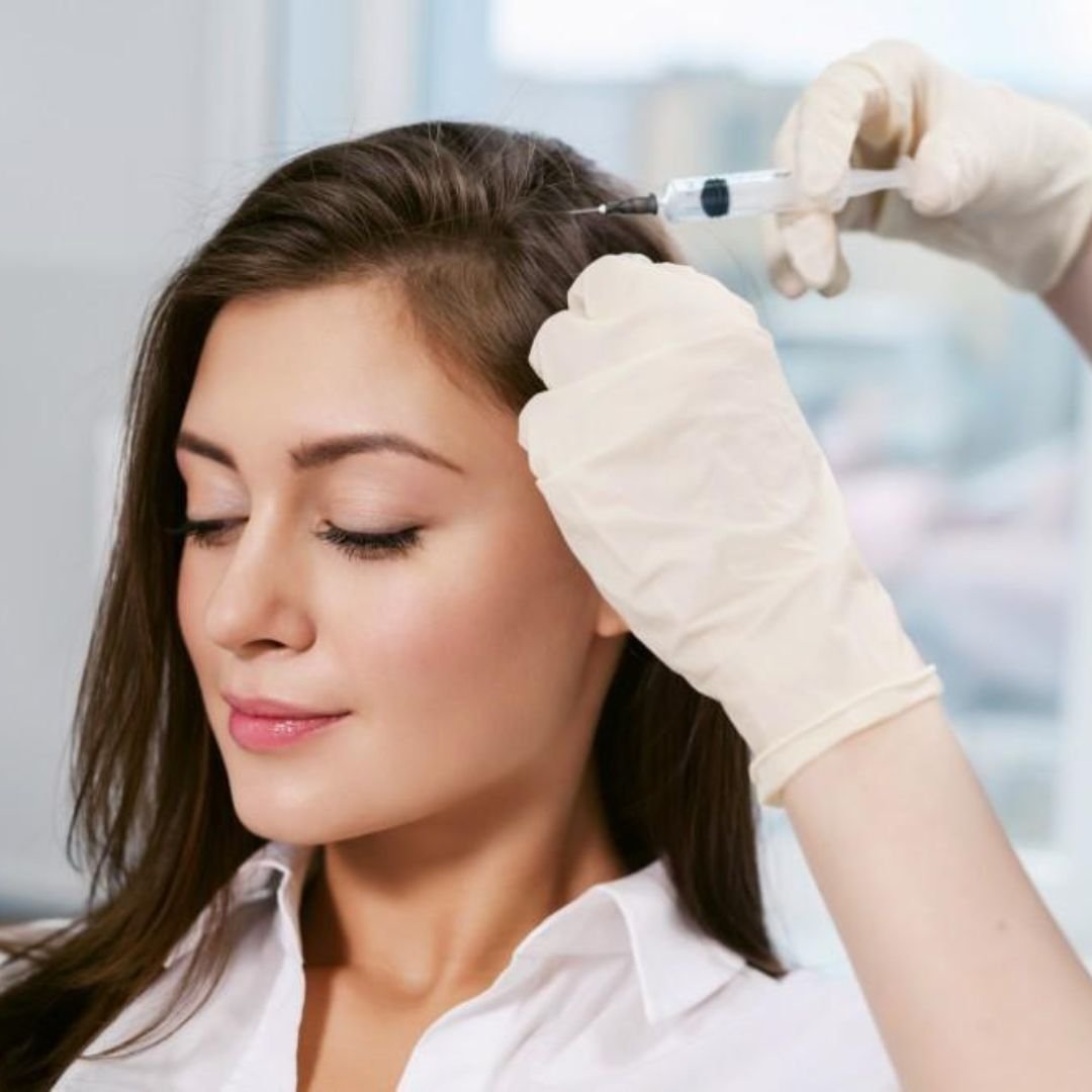 PRP Hair Restoration Braselton GA