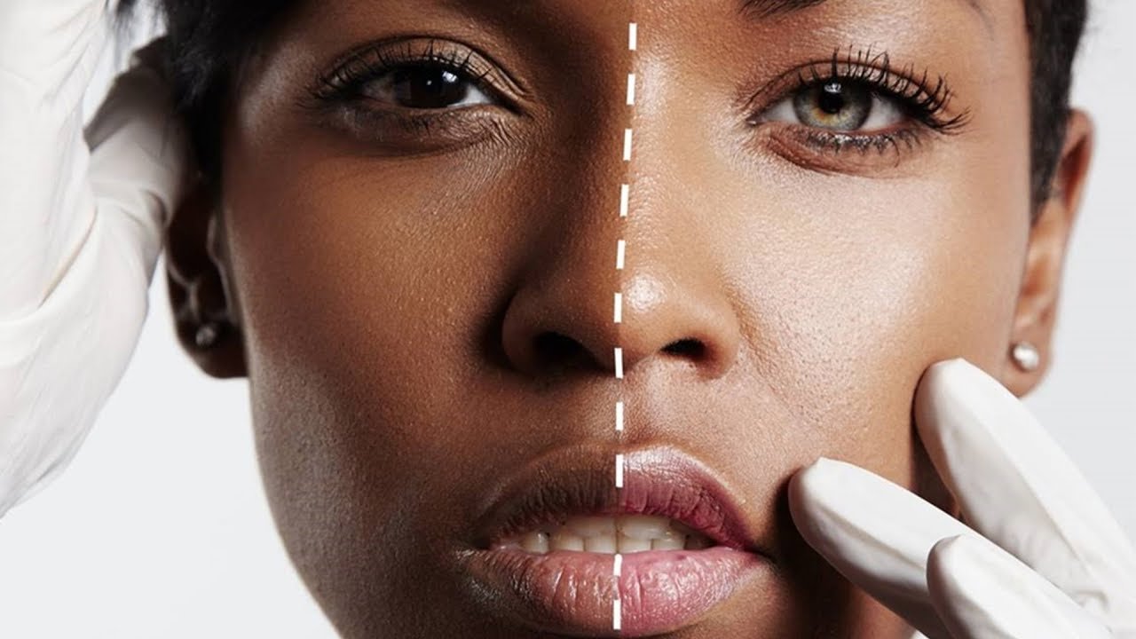 Are Skin Whitening Injections in Islamabad Safe? What Dermatologists Say