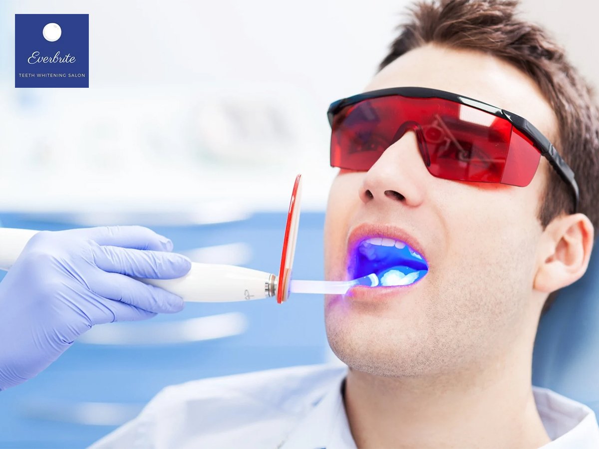 Trust Professionals for Safe, Effective Teeth Whitening