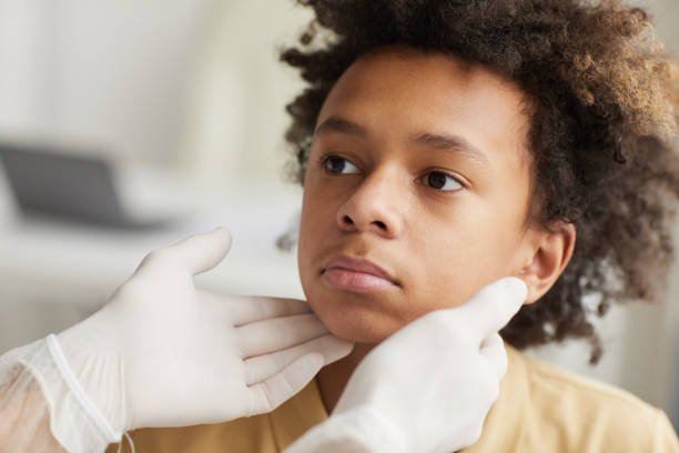 Rhinoplasty in Riyadh