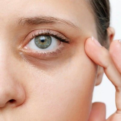 21الهالات-السوداء