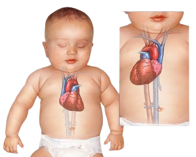 22698-removebg-preview