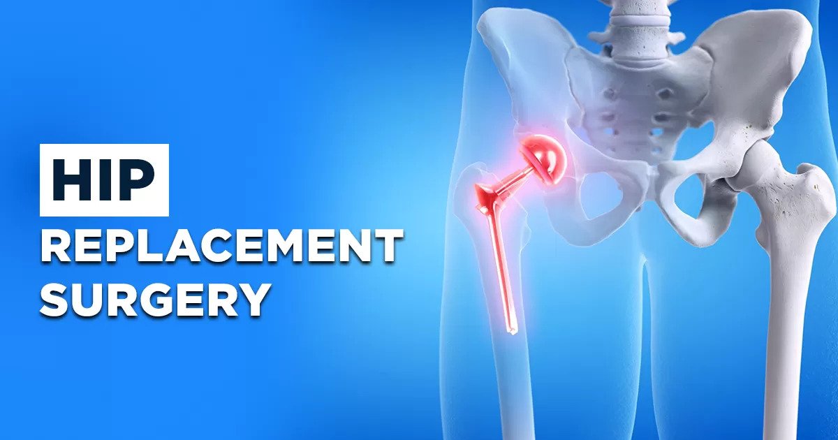 Book the Best Hip Replacement Surgery Hospital in Noida