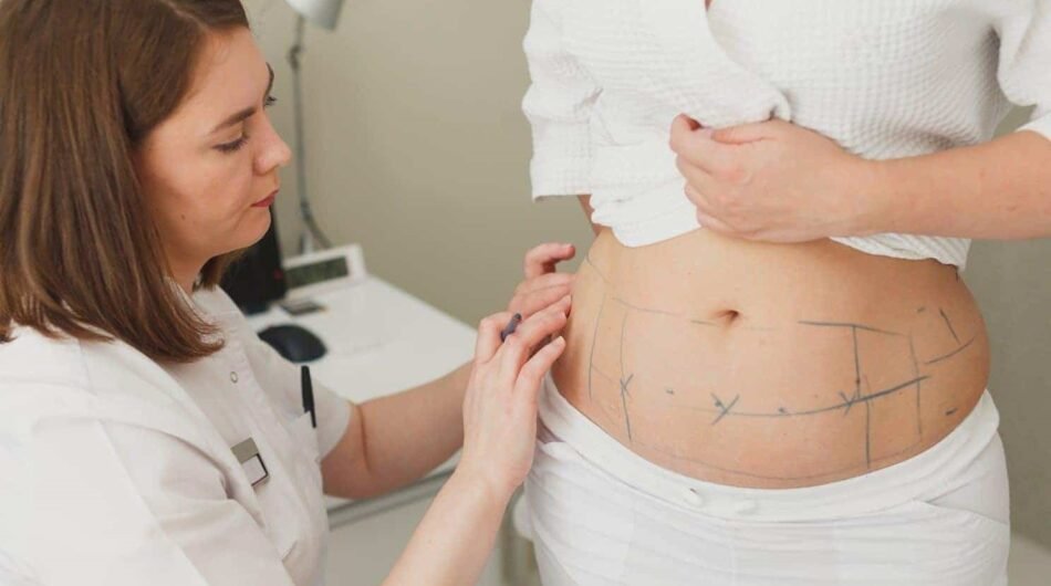Laser-Liposuction-in-Riyadh-9