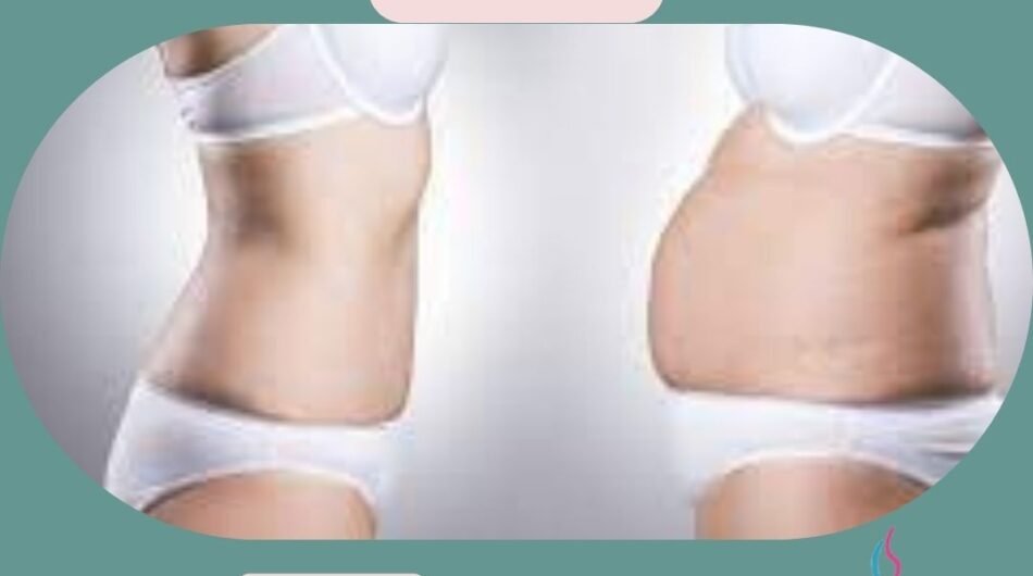 Mommy-Makeover-In-India