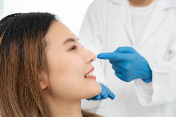 Rhinoplasty-in-Riyadh-5