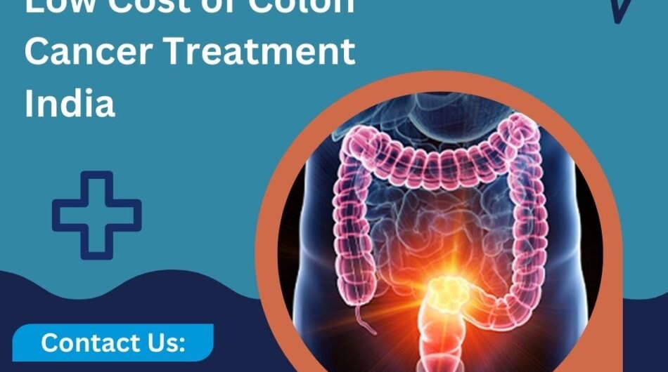 low-Cost-of-Colon-Cancer-Treatment-India