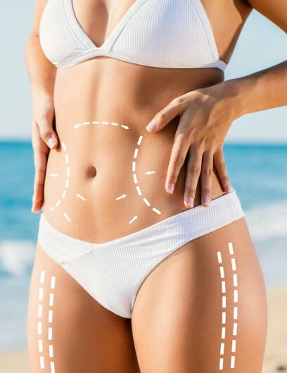 Liposuction in Riyadh