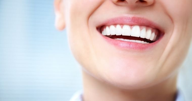 Composite veneers for teeth