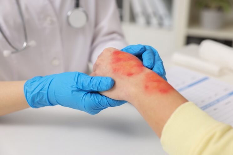 Acesso Biologics – Amniotic Membrane Allograft