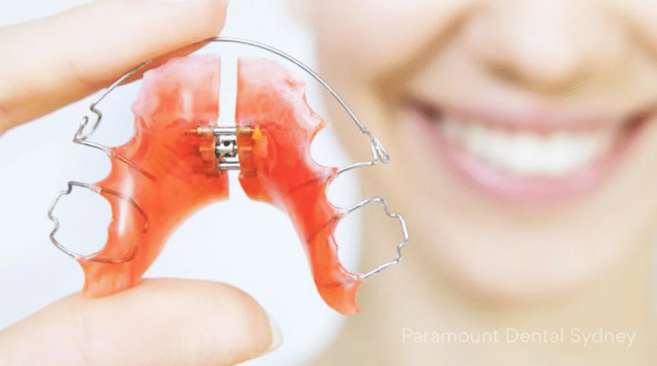 Dental-Appliances-in-Dubai-Abu-Dhabi