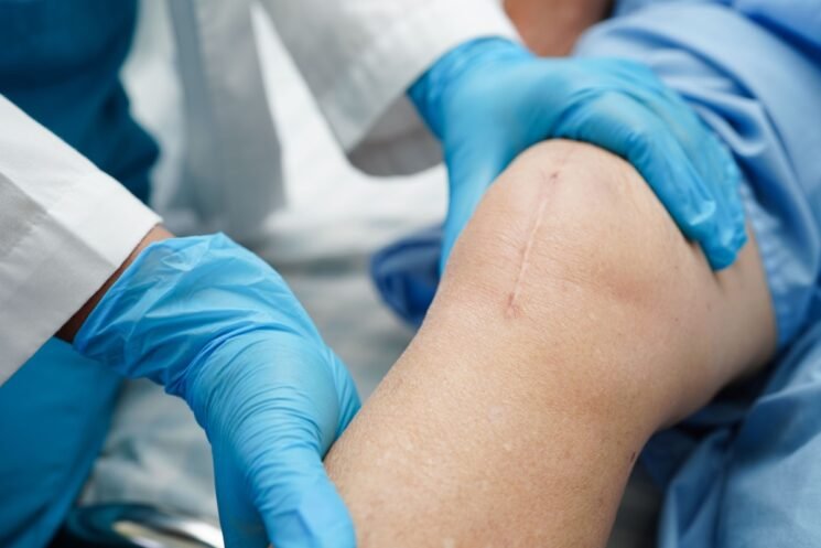 Acesso Biologics – Amniotic Membrane Allograft