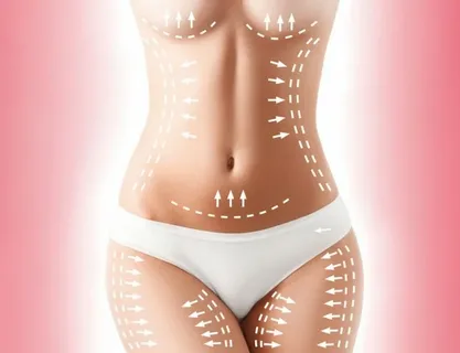 Liposuction-in-Riyadh-9