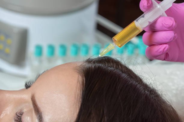 PRP Hair Treatment in Riyadh