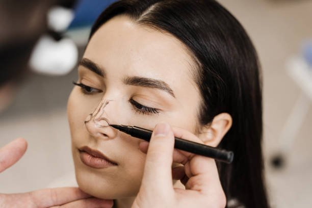 Where Science Meets Art in Rhinoplasty