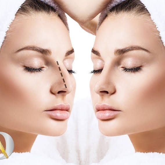 Where Science Meets Art in Rhinoplasty