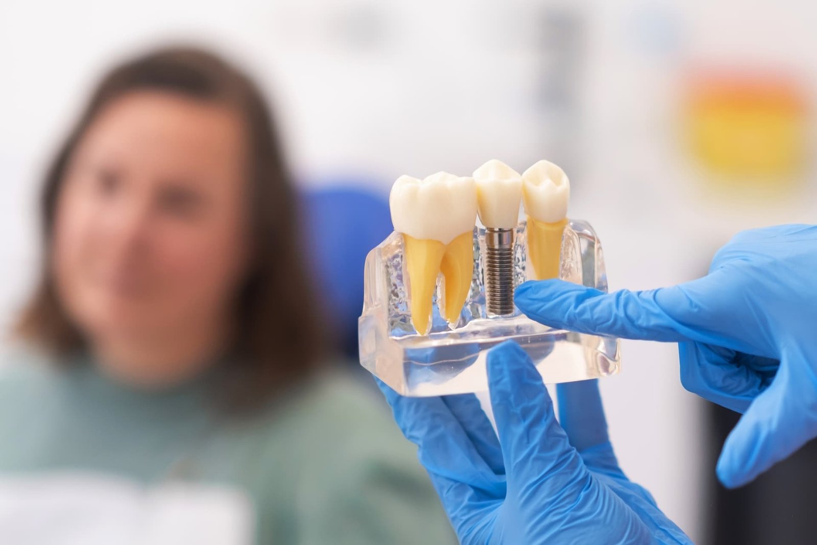 Advanced Dental Implant Treatment in Paschim Vihar