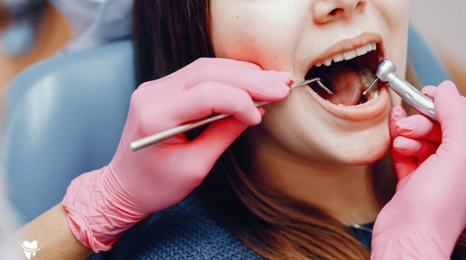 Dental-cleaning-Dubai