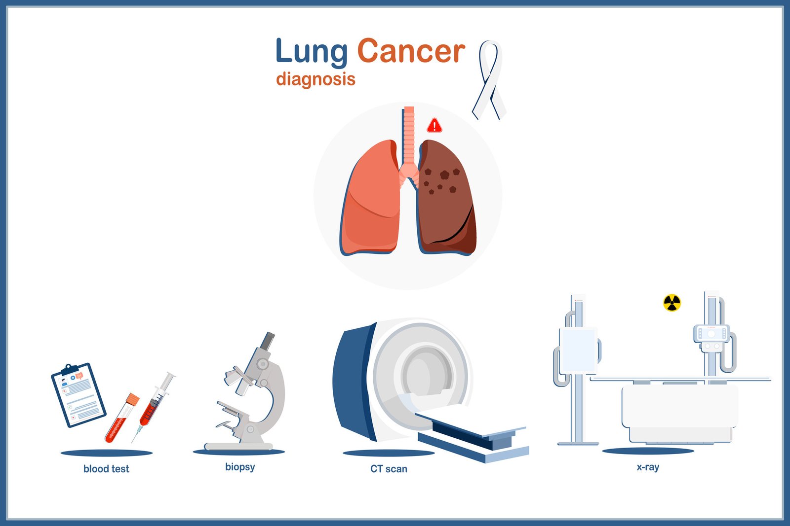 Top Specialists for Advanced Lung Cancer Treatment in Singapore