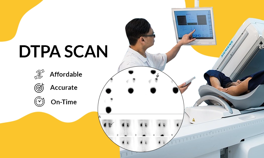DTPA Scan Price: What Patients Should Know Before Booking a Kidney Function Test