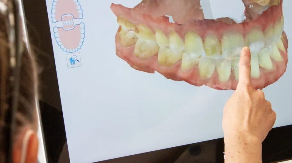 Aberdeen_Itero_Carasol_IMG_3012-1024×1024-1