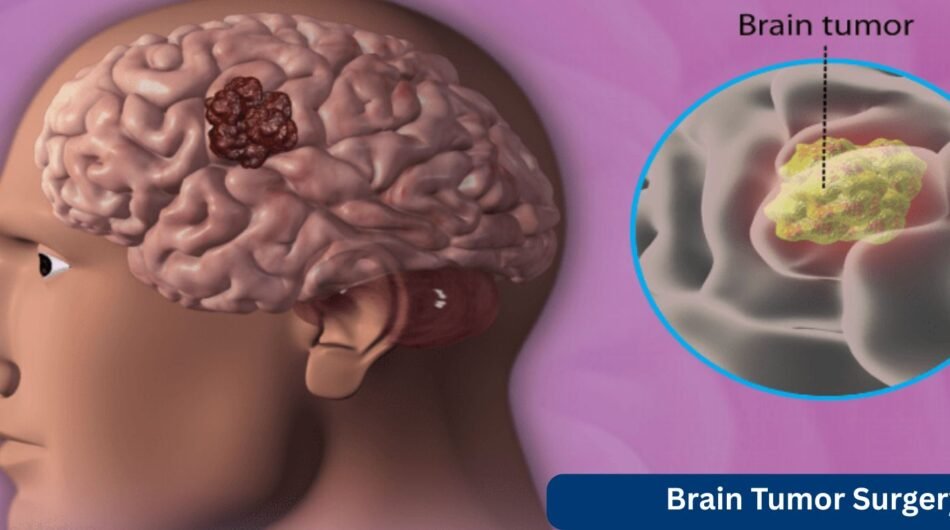 Brain-Tumor-Surgery-Cover