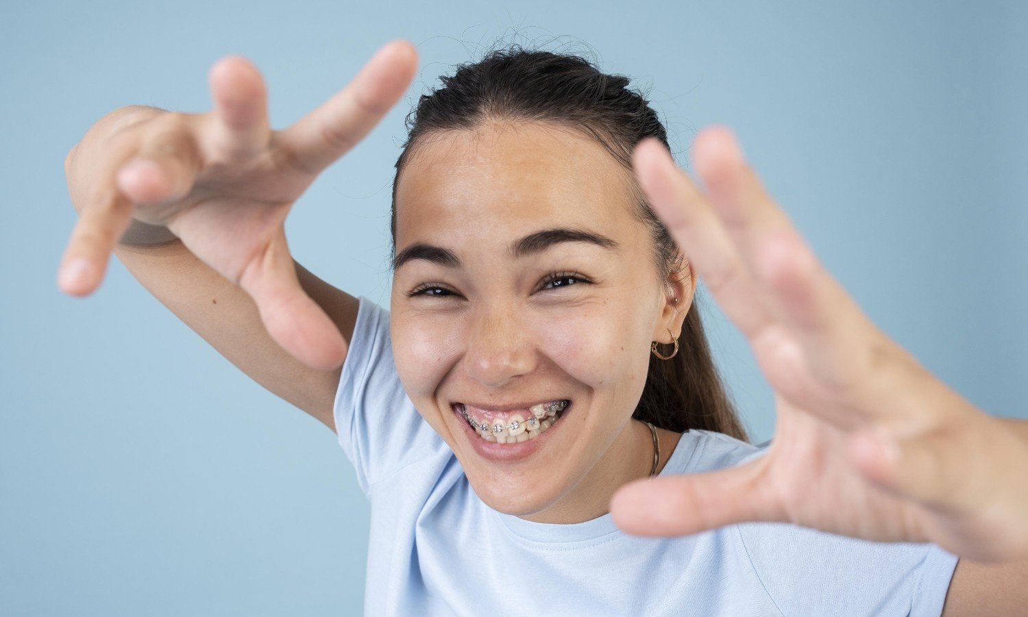 Affordable & Trusted Braces for Kids Singapore – Gentle Care