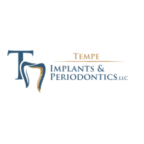 Ahwatukee Foothills Village Same Dental Implants