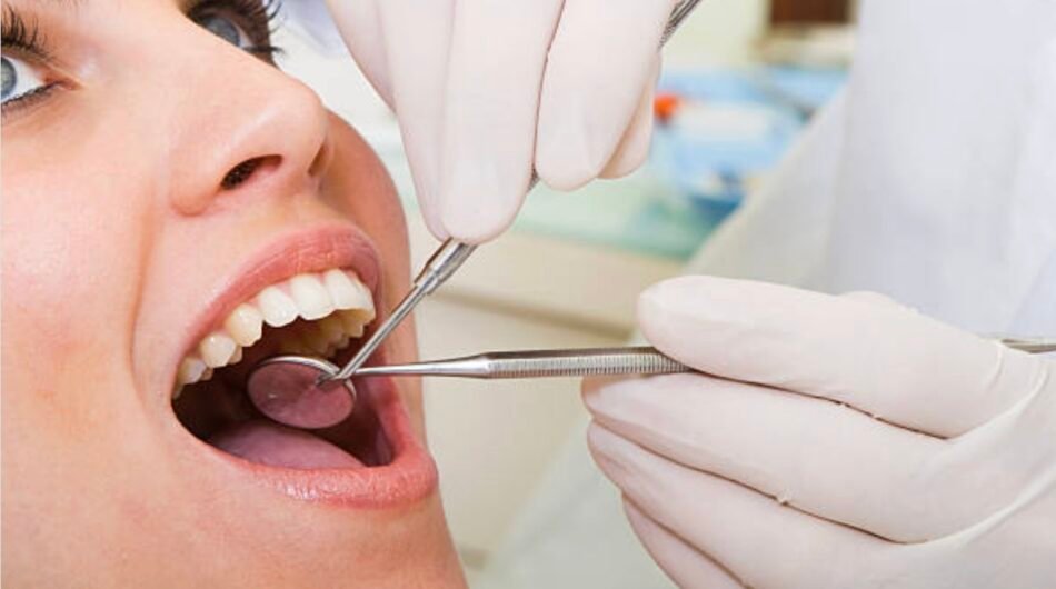 Root-Canal-Treatment-in-Mount-Roskill-Auckland