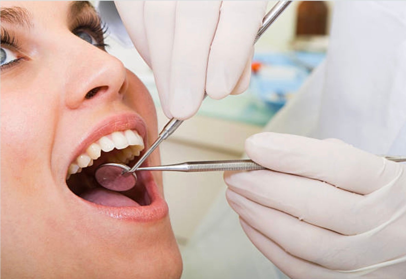 Root Canal Treatment in Mount Roskill, Auckland