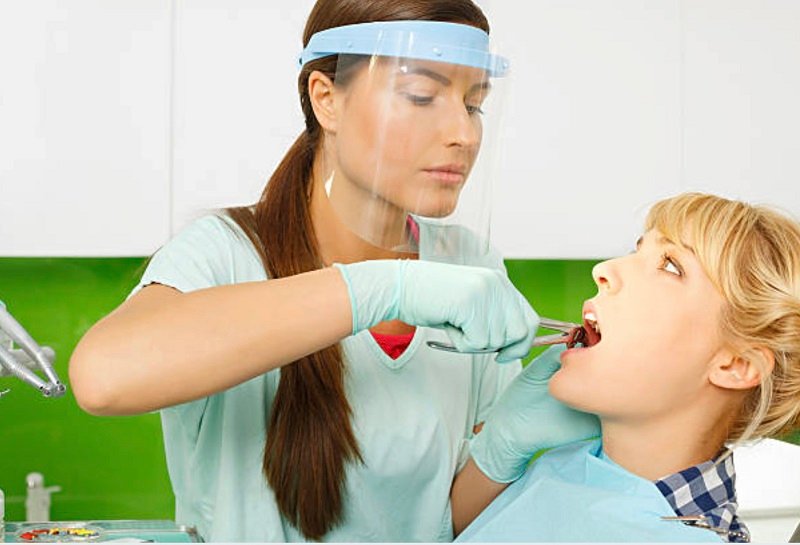 Tooth Extraction in Mount Roskill, Auckland