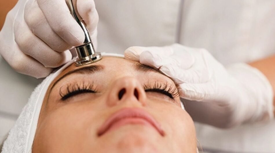 Microdermabrasion-Treatments
