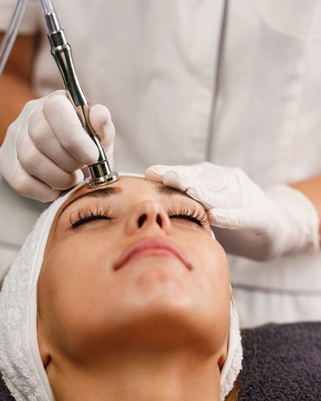 Microdermabrasion Treatments