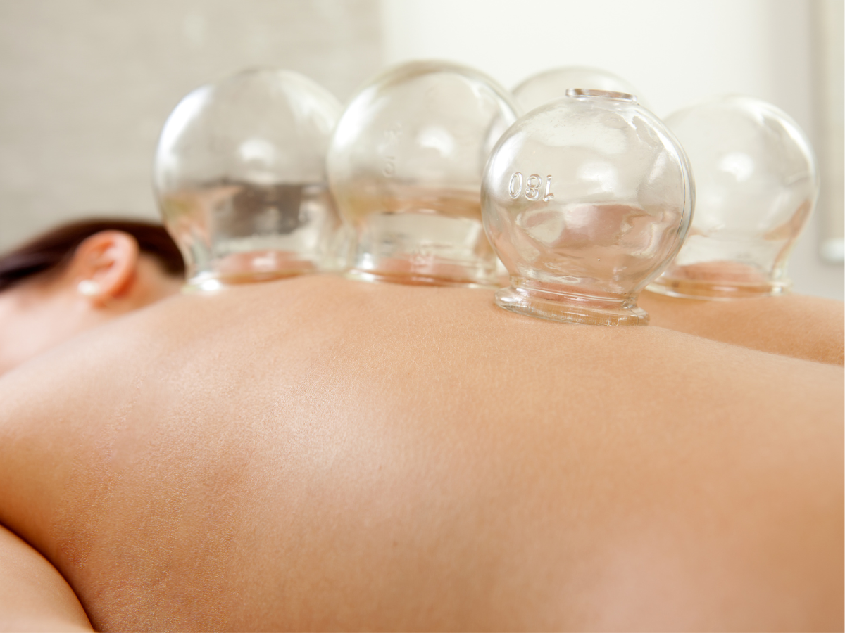 Cupping Therapy NYC