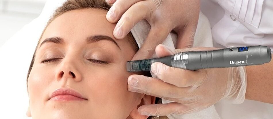 imgi_197_miconeedling