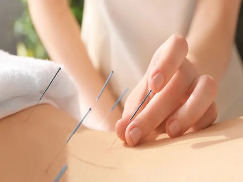 Bonline Oriental Medicine Clinic
