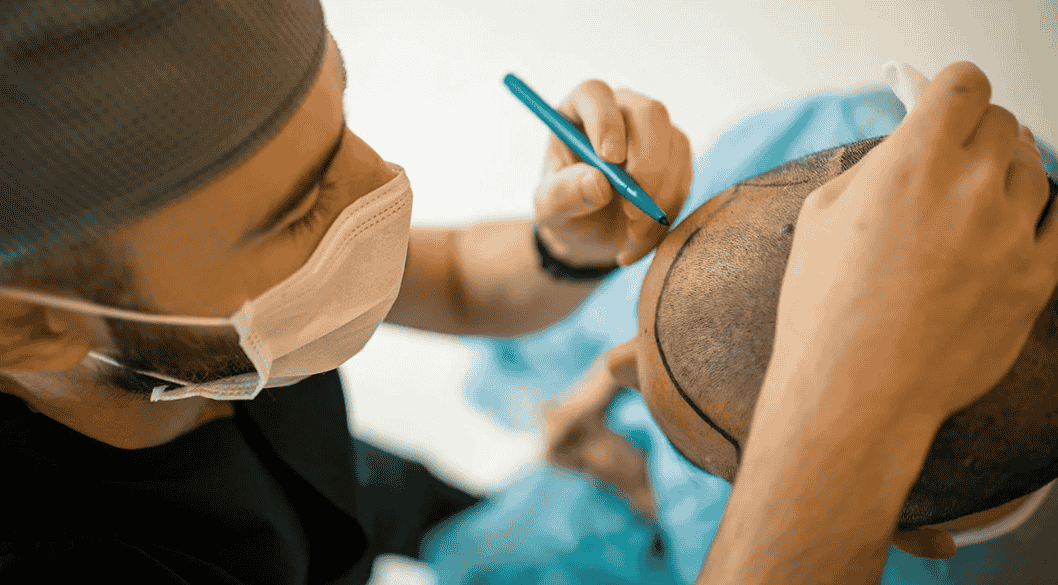 Advanced FUT Hair Transplant in Mumbai | Hair And Shape Clinic