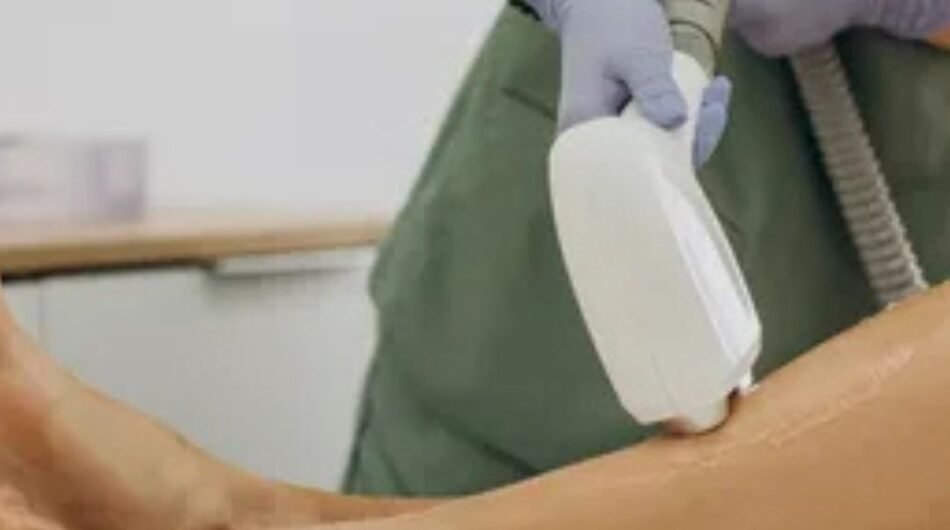 Laser-Hair-Removal-3