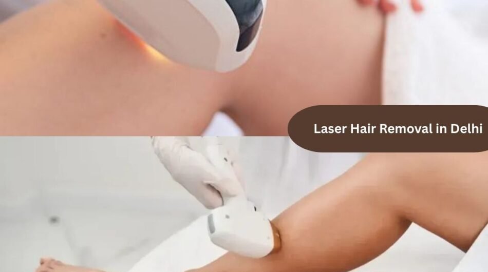 Laser-Hair-Removal-rohit