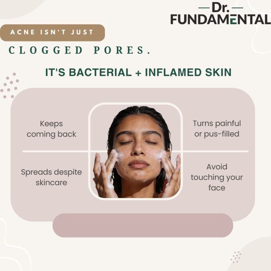 Pink-and-White-Acne-Problem-Tips-Instagram-Post