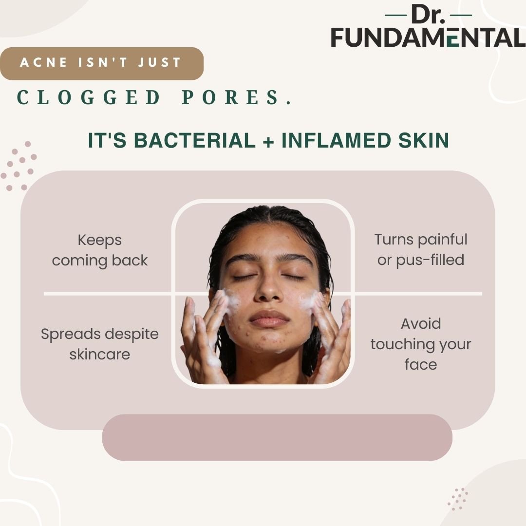 Dermaclar Oxy Acne Cleanser | Best Gel Cleanser for Oily Skin & Acne