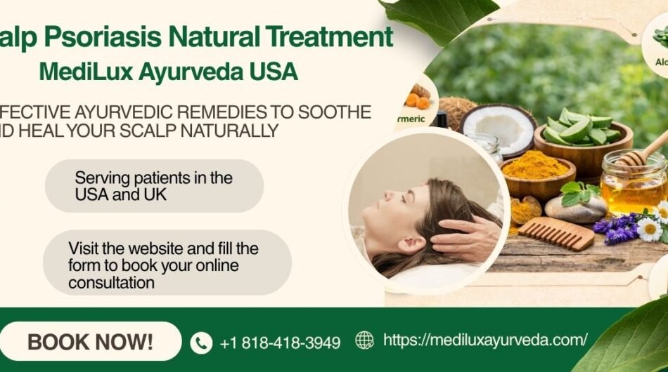 Scalp-Psoriasis-Natural-Treatment-